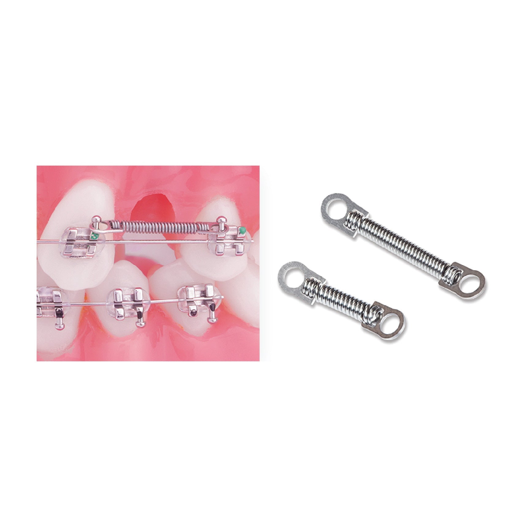 Clasps, Coil Springs, Stops & Locks