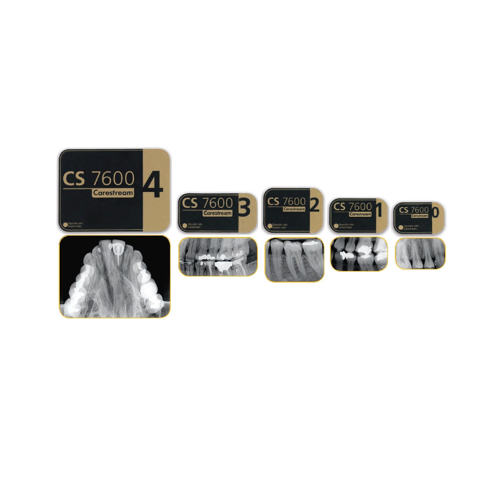 Digital Scan Plates
