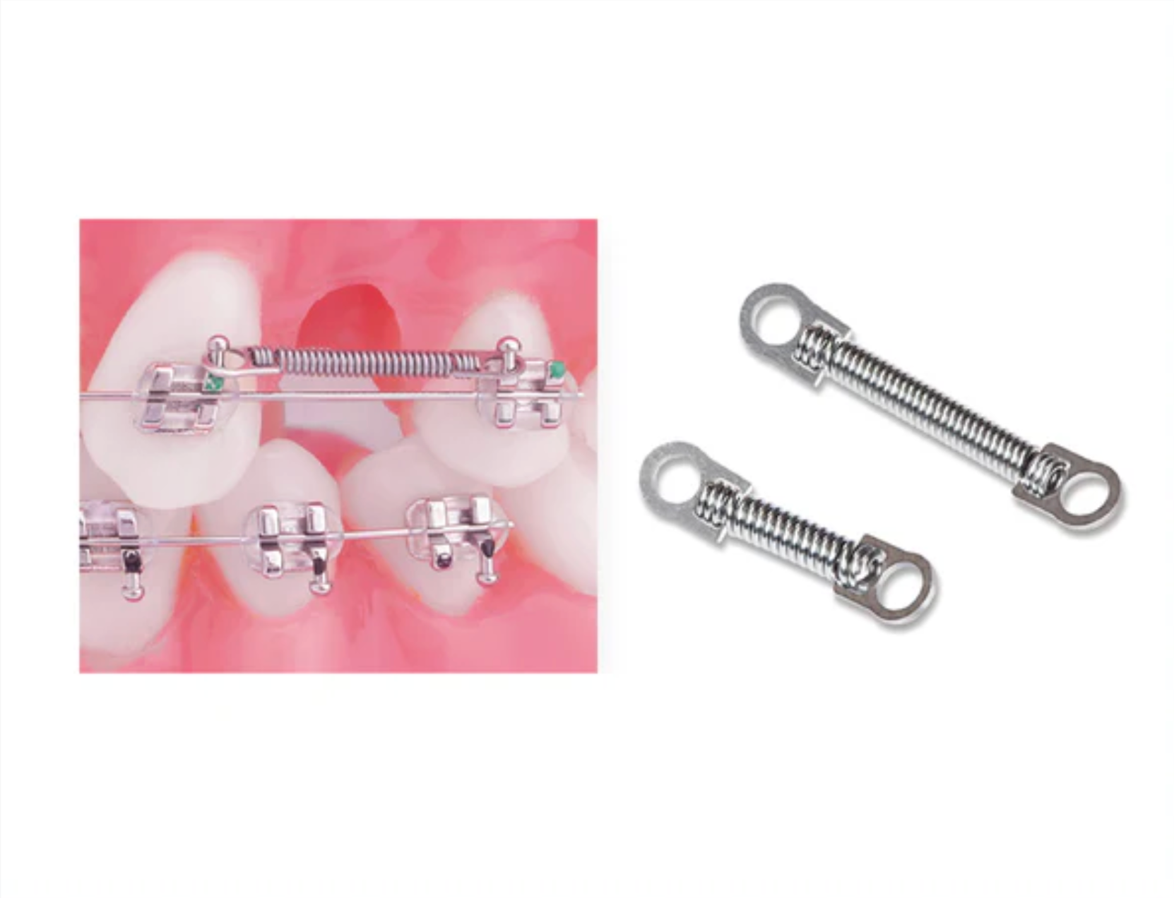 Clasps, Coil Springs, Stops & Locks